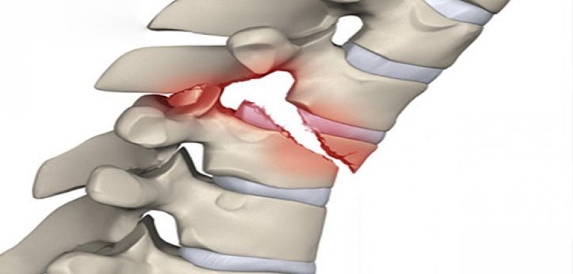Medulla Spinalis Yaralanması
